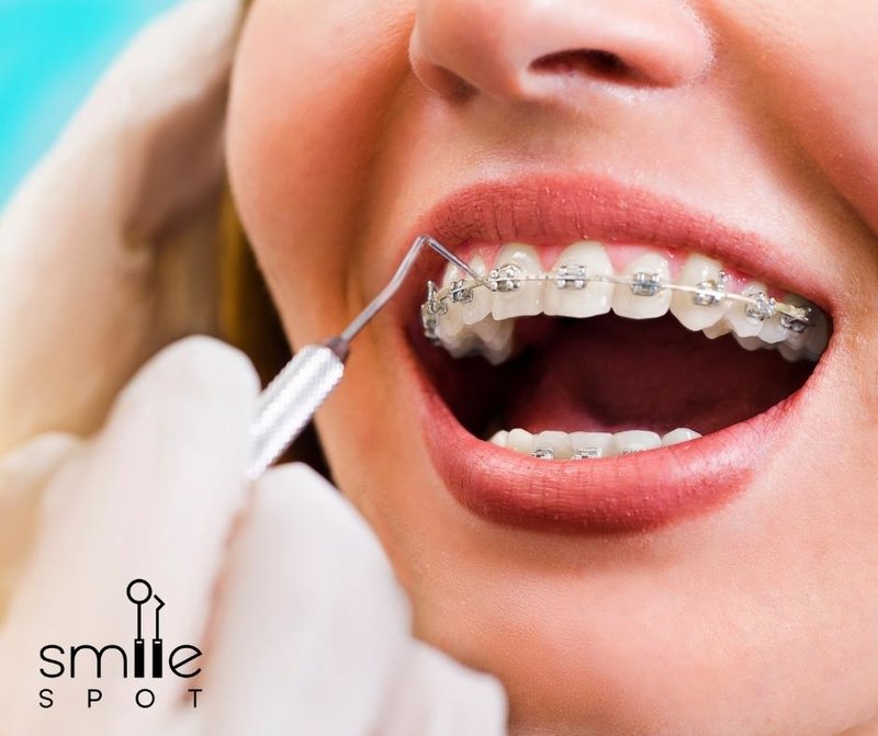 Smile Spot - Clinica Ortodontie