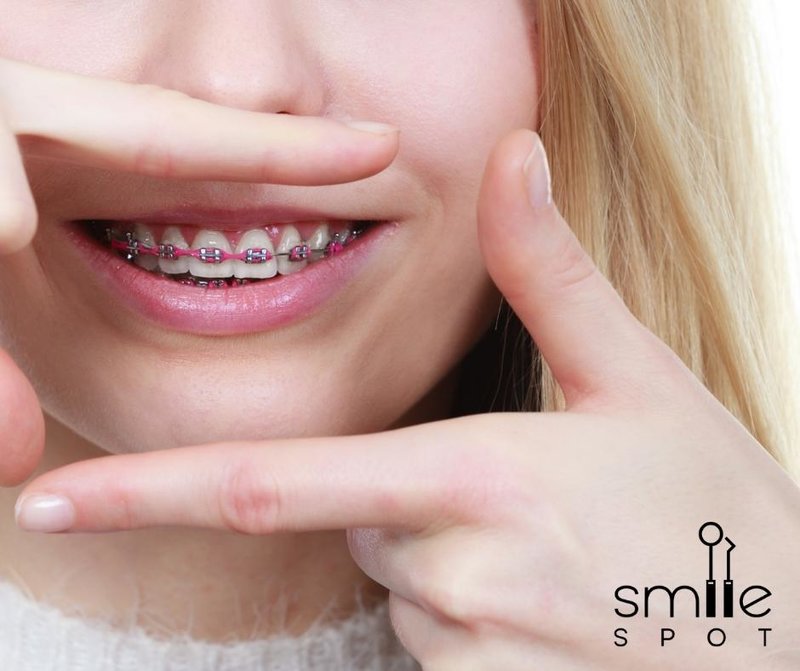 Smile Spot - Clinica Ortodontie