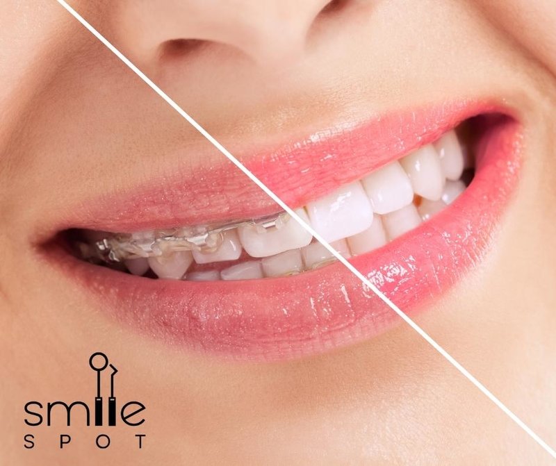 Smile Spot - Clinica Ortodontie