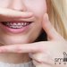 Smile Spot - Clinica Ortodontie
