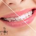 Smile Spot - Clinica Ortodontie